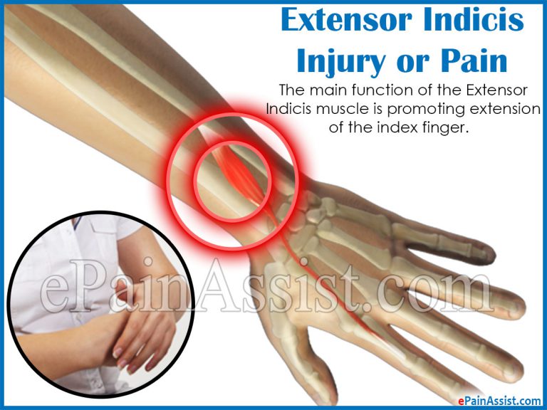 Extensor Indicis Injury or Pain: Symptoms, Causes, Treatment, Functions