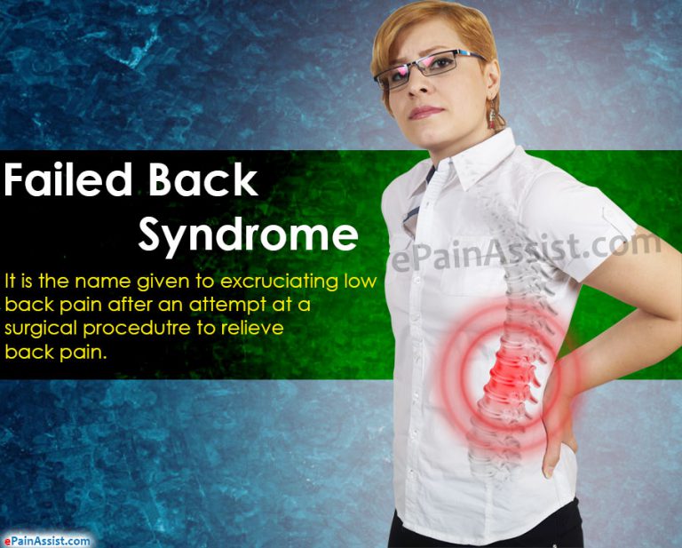 What is a Failed Back Syndrome & How is it Treated?