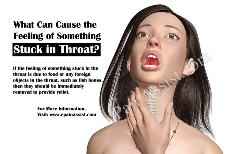 What Can Cause the Feeling of Something Stuck in Throat?