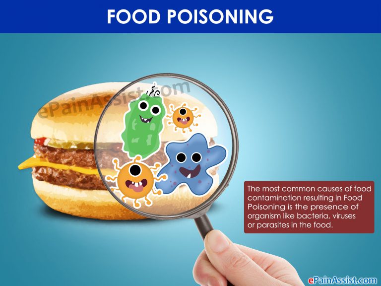 Onset of Food Poisoning & How Long Does it Last | Causes, Symptom, Treatment, Home Remedies of Food Poisoning