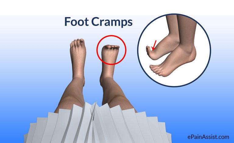 Foot Cramps or Toe Cramps: Causes, Symptoms, Treatment, Ways To Get Rid of Cramps