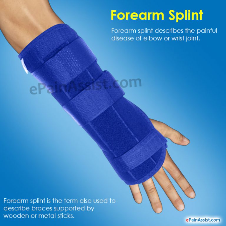 Forearm Splint: Forearm Pain & Treatment Brace