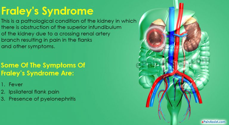 Fraley’s Syndrome: Causes, Symptoms, Diagnosis, Treatment
