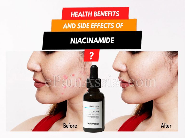 Health Benefits and Side Effects of Niacinamide