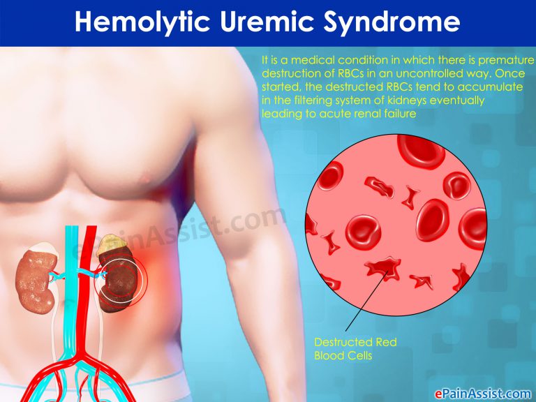 What is Hemolytic Uremic Syndrome?