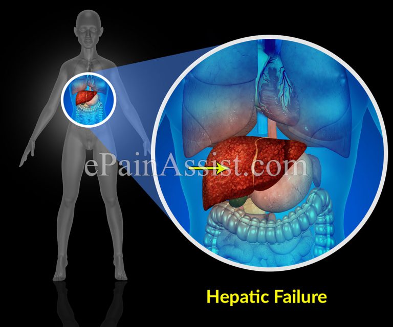 Hepatic Failure: Types, Causes, Symptoms, Treatment, Pathophysiology