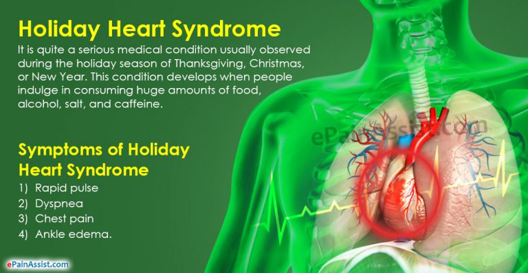 Holiday Heart Syndrome: Causes, Symptoms, Treatment, Prognosis