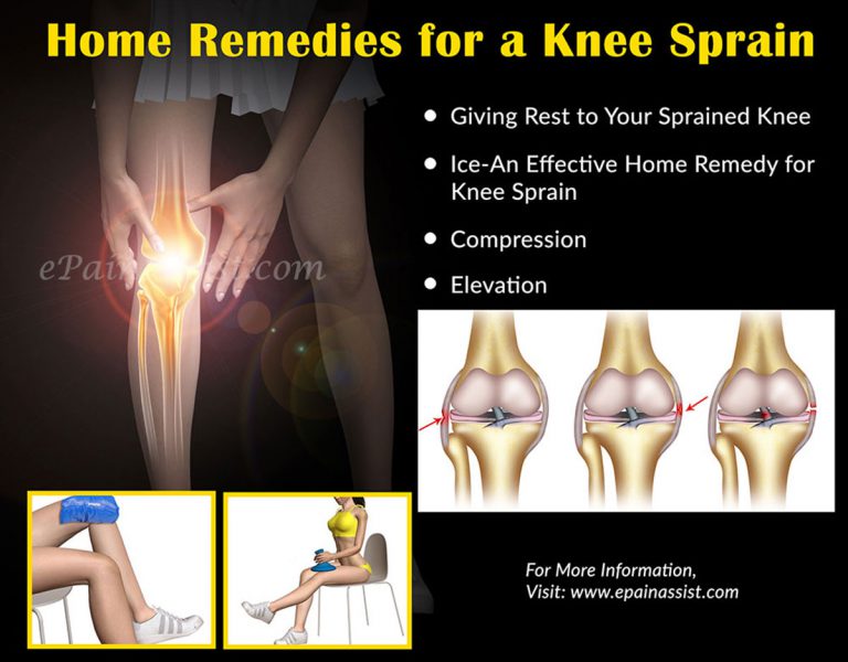 Home Remedies and Exercises for Knee Sprain
