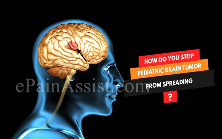 How Do You Stop Pediatric Brain Tumor From Spreading & How Dangerous Is It & Is It Contagious?