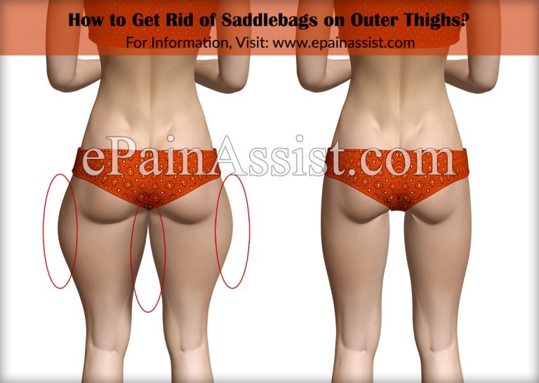How to Get Rid of Saddlebags on Outer Thighs?