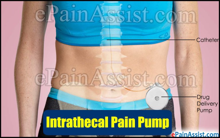 Intrathecal Pain Pump: Post-Surgical Complications