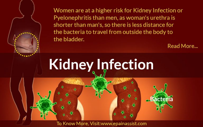 Kidney Infection or Pyelonephritis: Causes, Signs, Symptoms, Treatment, Home Remedies, Prevention