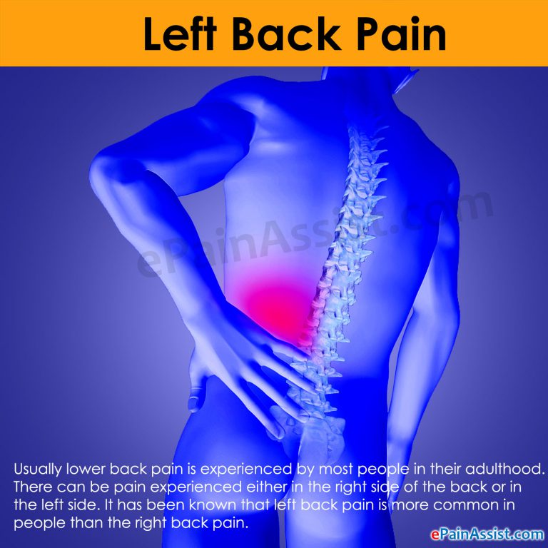 Left Back Pain: Symptoms, Causes, Treatment, Prevention