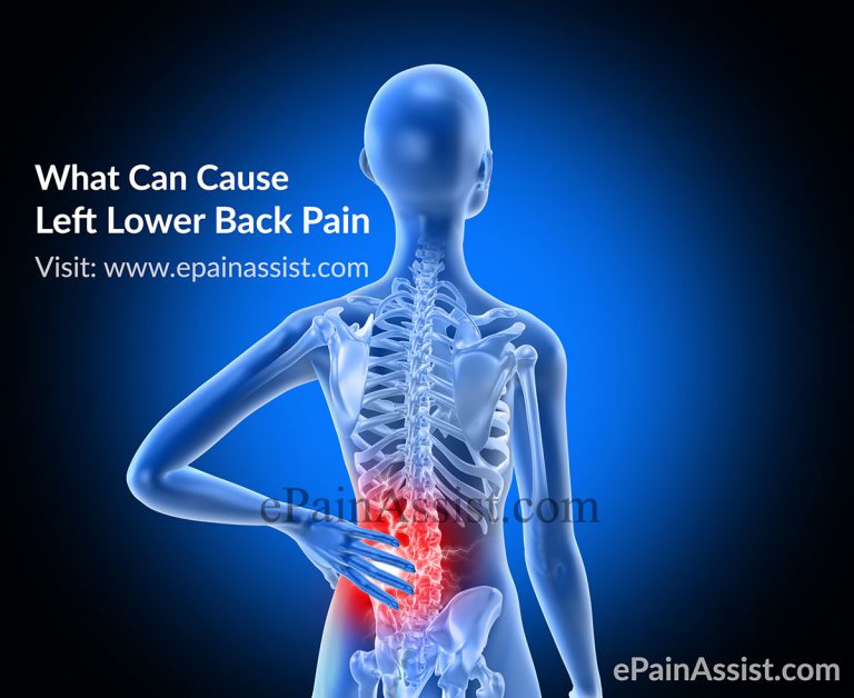 What Can Cause Left Lower Back Pain: Symptoms, Treatment
