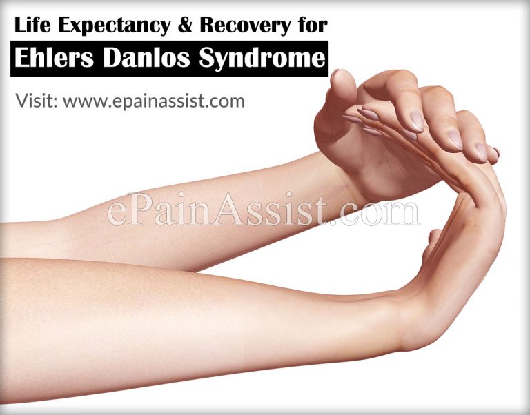 Life Expectancy & Recovery for Ehlers Danlos Syndrome or EDS