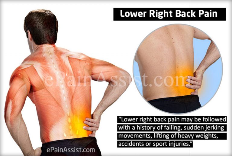 Lower Right Back Pain: Causes, Symptoms, Treatment