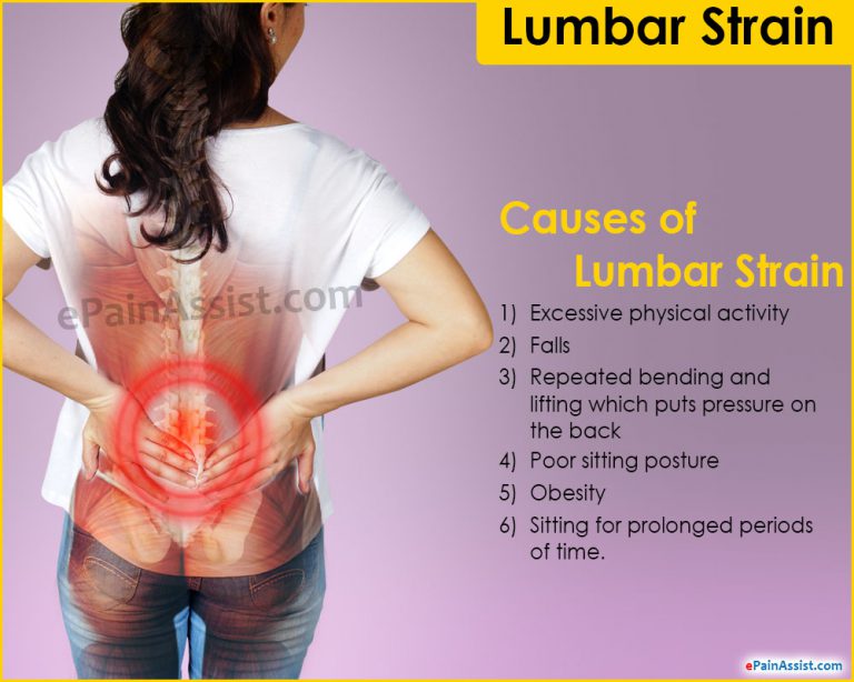 Lumbar Strain: Causes, Symptoms, Treatment, Recovery, Prevention