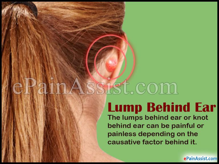 Lump Behind Ear or Knot Behind Ear: Causes, Treatment, Diagnosis
