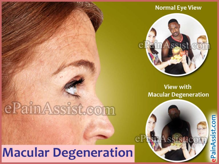 Macular Degeneration Treatment: Stem Cell Technology