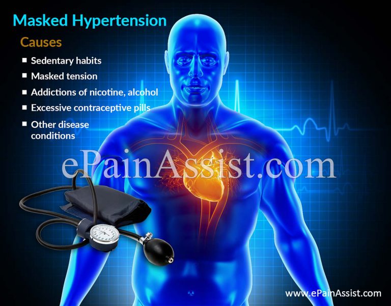 Masked Hypertension (MH): Overview, Causes, Difference between MH and White Coat Hypertension, Identifying MH Patients, Patient Management