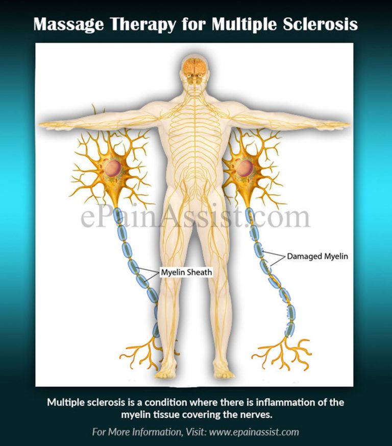 Massage Therapy for Multiple Sclerosis (MS): Benefits- Pain, Stress Reduction
