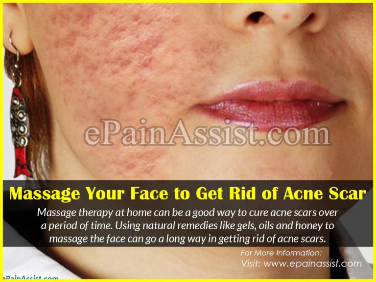 Massage Your Face to Get Rid of Acne Scars