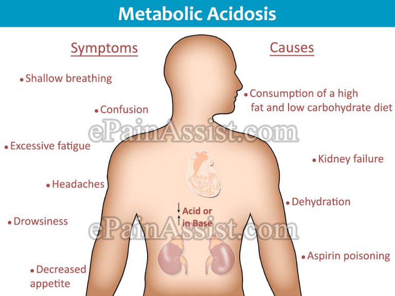 Metabolic Acidosis: Causes, Symptoms, Diagnosis, Treatment, Prognosis, Prevention