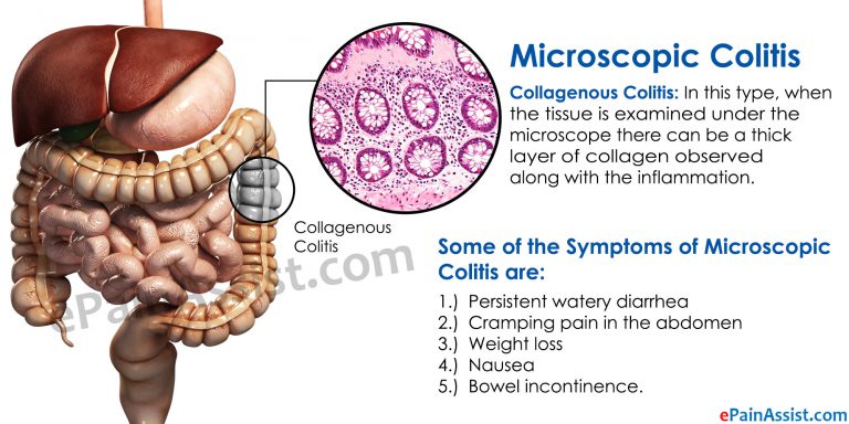 Microscopic Colitis: Causes, Symptoms, Diagnosis, Treatment, Diet