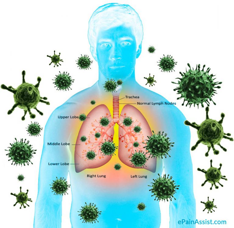 Middle Eastern Respiratory Syndrome or Coronavirus: Source, Symptoms, Treatment, Prevention