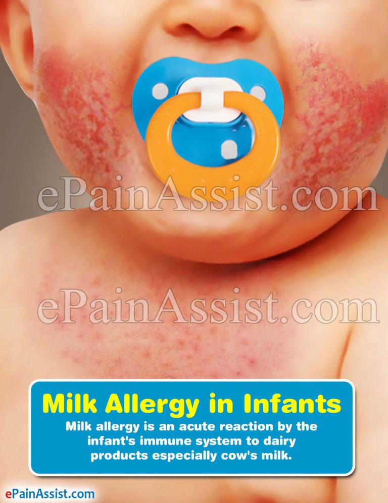 Milk Allergy in Infants: Causes, Symptoms, Tests, Treatment