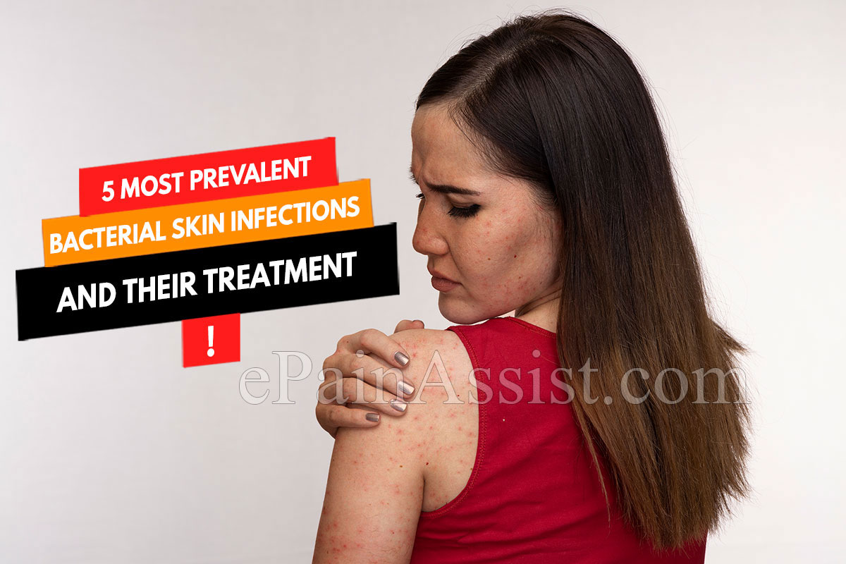 5 Most Prevalent Bacterial Skin Infections and their Treatment