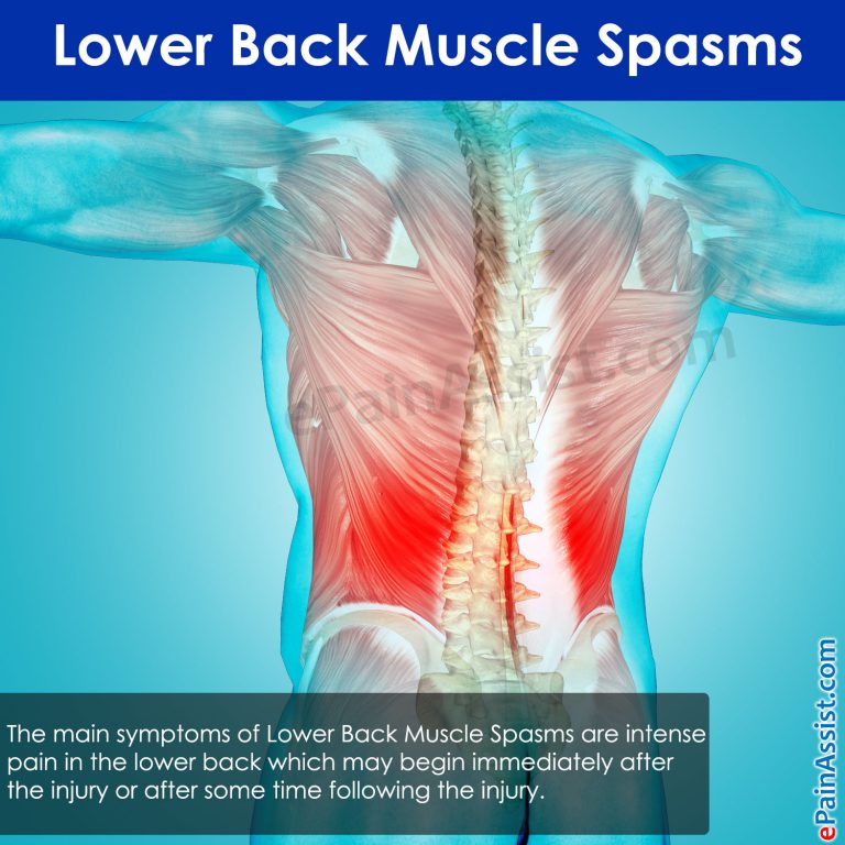 Lower Back Muscle Spasms: Causes, Symptoms, Treatment