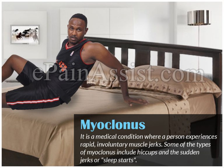 Myoclonus: Causes, Symptoms, Investigations, Treatment