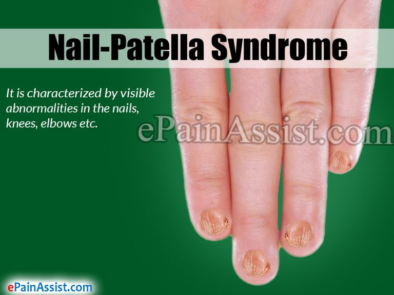 Nail-Patella Syndrome: Causes, Symptoms, Diagnosis, Treatment