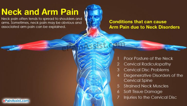Neck and Arm Pain: Can your Arm Pain be Related to Neck Pain?
