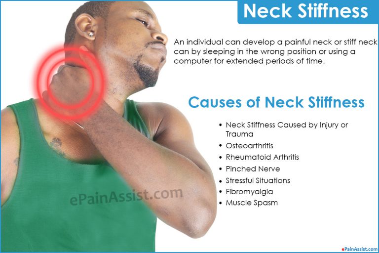 Neck Stiffness: Causes, Symptoms, Diagnosis, Treatment, Home Remedies, Exercises