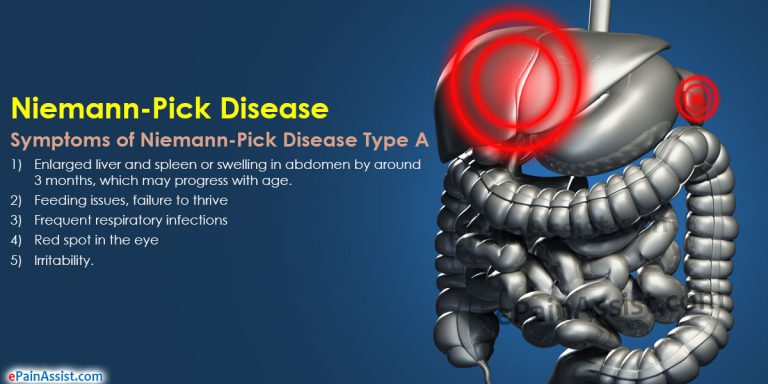 Niemann-Pick Disease: Types, Causes, Symptoms, Diagnosis, Treatment, Prognosis, Prevention