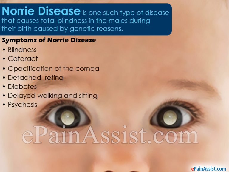 Norrie Disease: Symptoms, Treatment, Pathophysiology, Causes, Prognosis