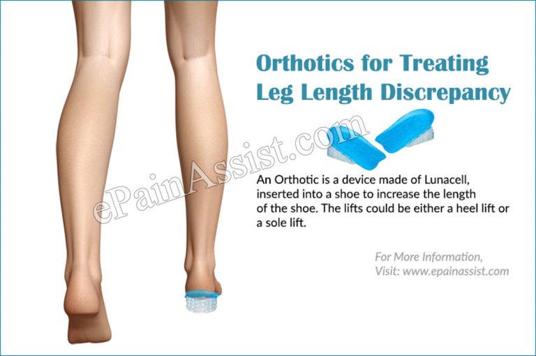 Leg Length Discrepancy (LLD) Treatment, Orthotics, Surgery, Coping, Recovery Period