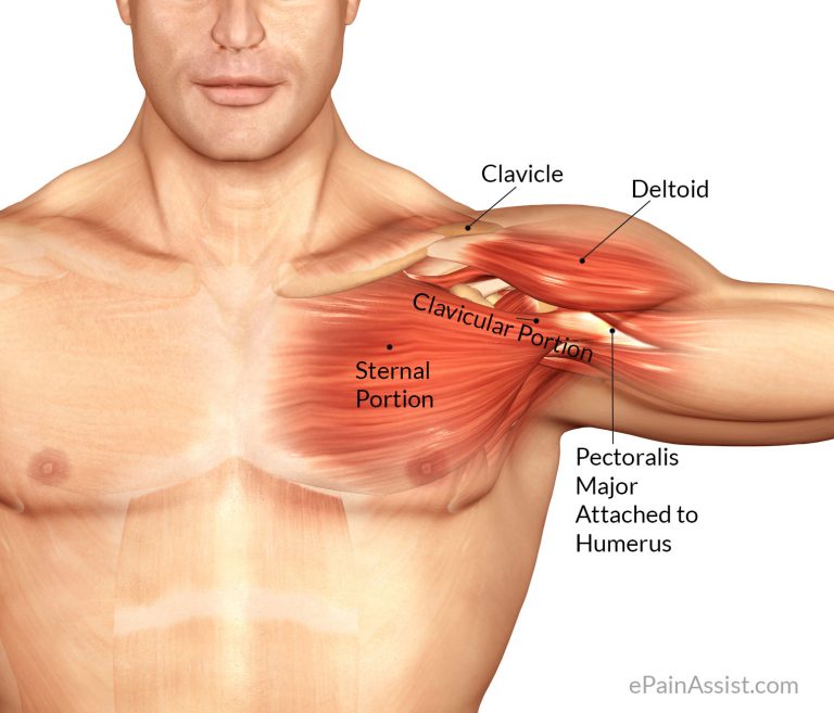 Pectoralis Major Inflammation: Causes, Symptoms, Diagnosis, Treatment, PT