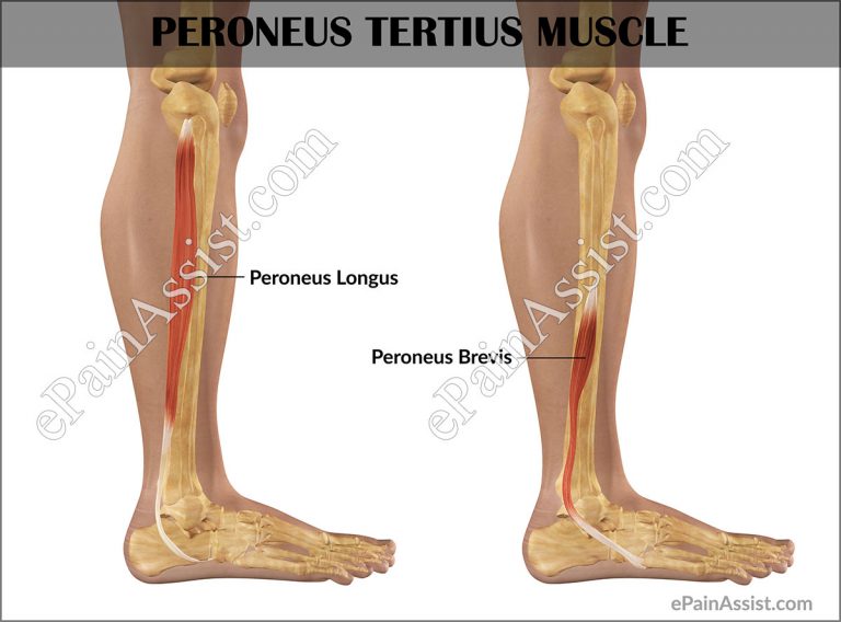 Peroneus Tertius Strain: Causes, Symptoms, Treatment, Recovery