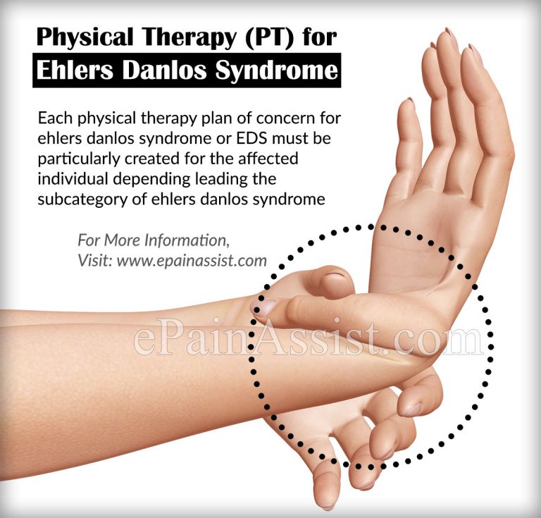 Ehlers Danlos Syndrome or EDS: Physical Therapy, Home Remedies, Coping Tips
