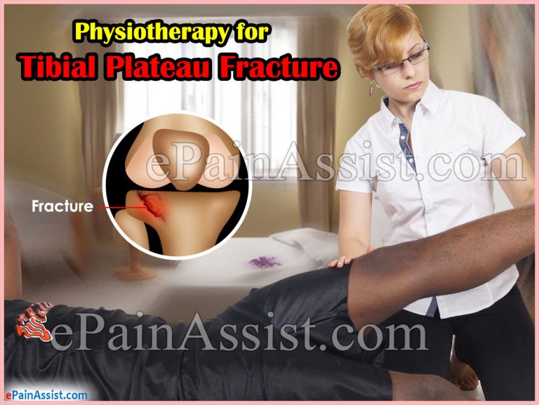Physiotherapy and Recovery for Fractured Tibial Plateau or Tibial Plateau Fractures