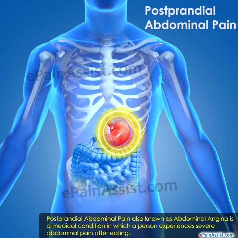 Postprandial Abdominal Pain