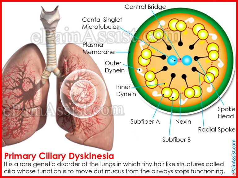 Primary Ciliary Dyskinesia: How Does It Affect The Body And Is It A Serious Disease?