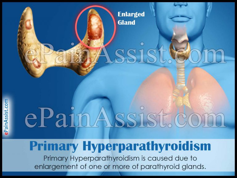 Primary Hyperparathyroidism : Causes, Risk Factors, Symptoms, Diagnosis, Treatment, Home Remedies