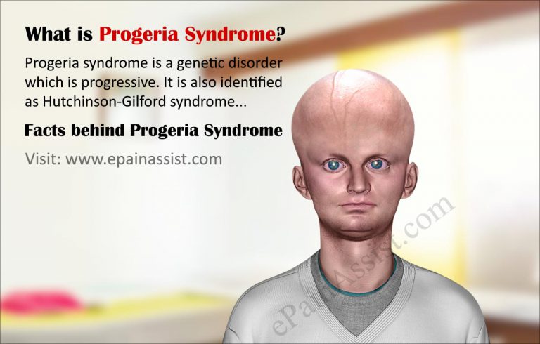 Progeria Syndrome: Facts, Causes, Symptoms, Life Expectancy