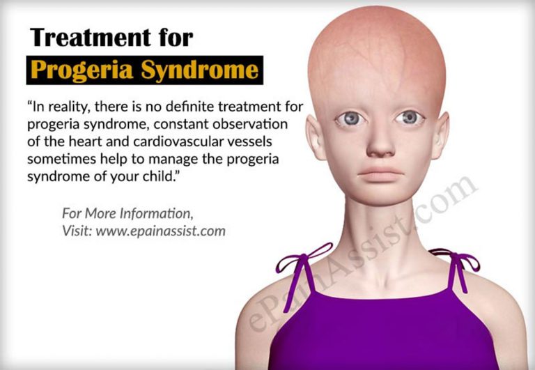 Progeria Syndrome: Treatment, Lifestyle Changes, Coping, Prognosis