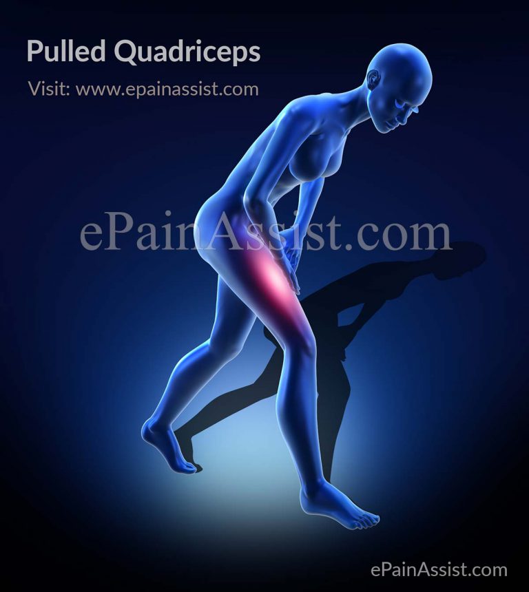 Pulled Quadriceps