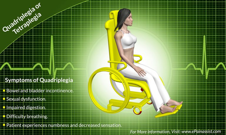 Quadriplegia or Tetraplegia: Causes, Signs, Symptoms, Treatment- Surgery
